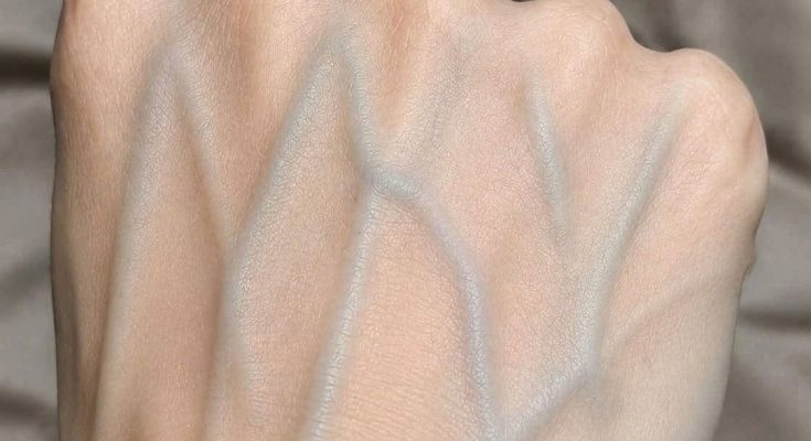 Featured image for Visible Veins on Your Hands? Here’s What They Coul