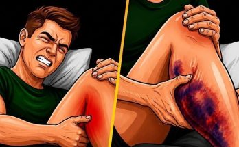 Featured image for If You Get Leg Cramps at Night, You Need to Know T