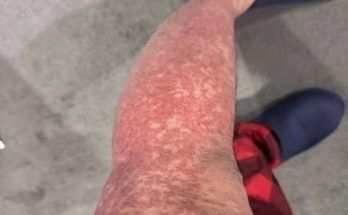 Featured image for Here Are the Consequences of Sleeping With... (A G