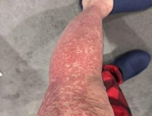 Featured image for Here Are the Consequences of Sleeping With... (A G